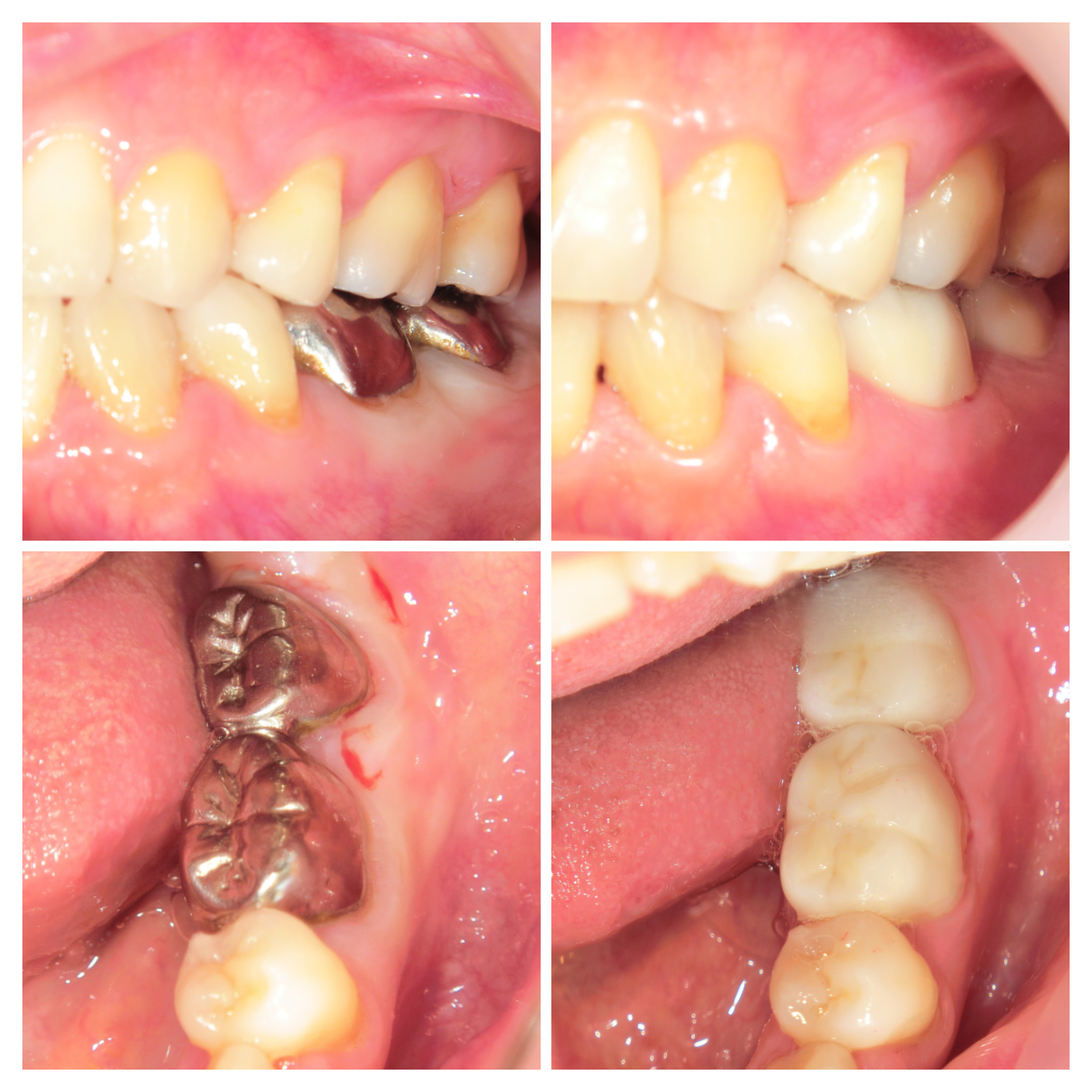 2013-08-21 16.06.19_collage.jpg1.jpg