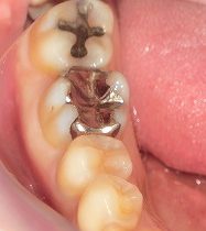 白い歯で笑顔に