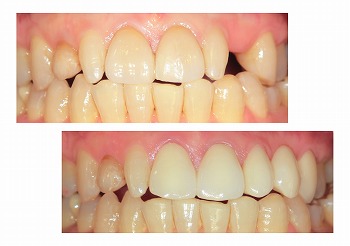 2016-03-14 17.50.24_collage.jpg