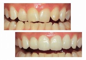 レアリング～綺麗な歯並びに～