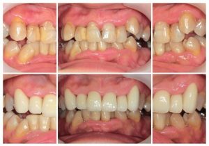 レアリング～綺麗な歯並びに～