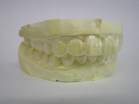 自宅でも出来る歯周病予防！ 3ＤＳ法